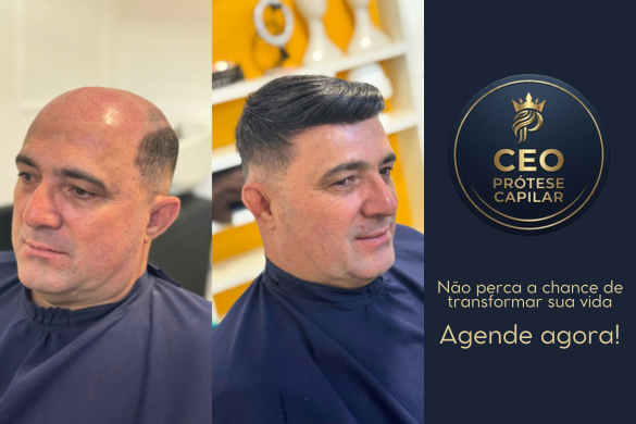 Antes e depois